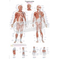 "Trigger Point" - Anatomisk Plakat