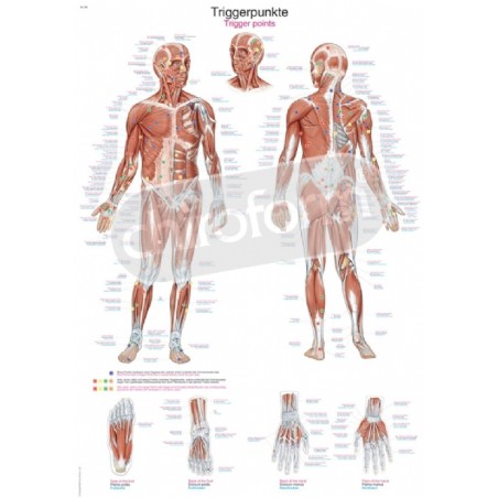 "Trigger Points" - Anatomical Chart
