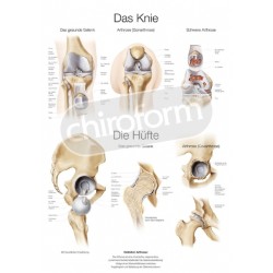 "Das Knie/ Die Hüfte" - Anatomisk Plakat