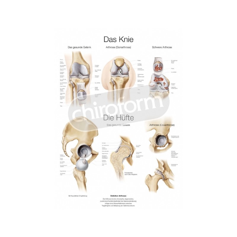"Das Knie/ Die Hüfte" - Anatomisk Plakat