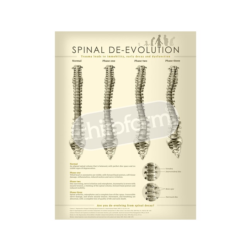 "Spinal De-evolution" - Anatomisk Plakat