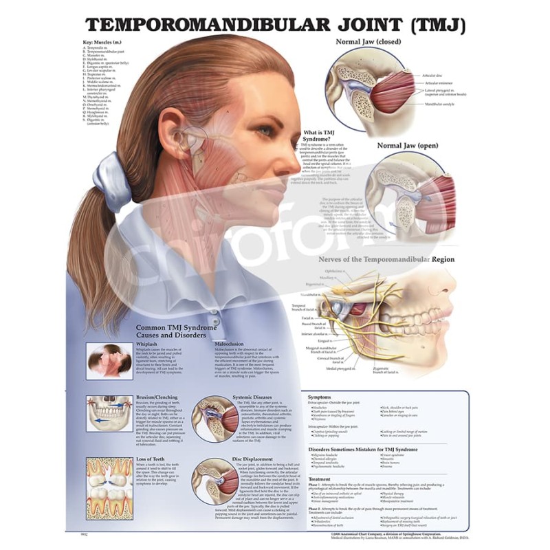 "Temporomandibular Joint" - Anatomisk Plakat
