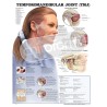 "Temporomandibular Joint" - Anatomisk Plakat