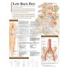 "Understanding Low Back Pain" - Anatomical Chart