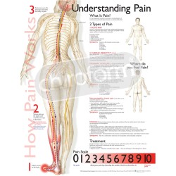 "Understanding Pain" - Anatomisk Plakat