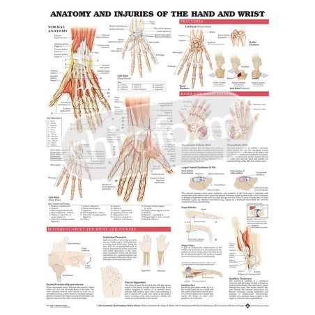 "Anatomy and Injuries of the Hand and Wrist" - Anatomisk Plakat