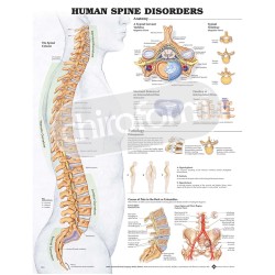 "Human Spine Disorders" - Anatomisk Plakat