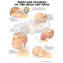 Whiplash Injuries of the...