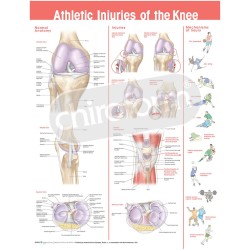 "Athletic Injuries of the Knee" - Anatomisk Plakat