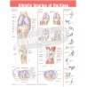 "Athletic Injuries of the Knee" - Anatomisk Plakat