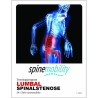 Lumbal Spinal Stenosis Hæfte