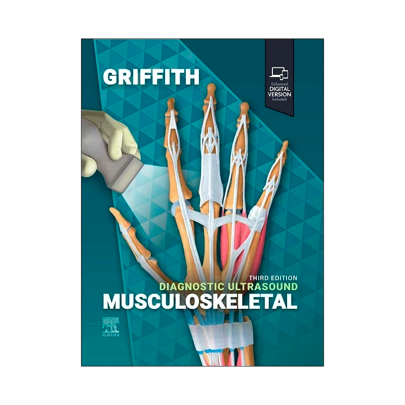 Diagnostic Ultrasound: Musculoskeletal 3rd Edition Bog af James F. Griffith