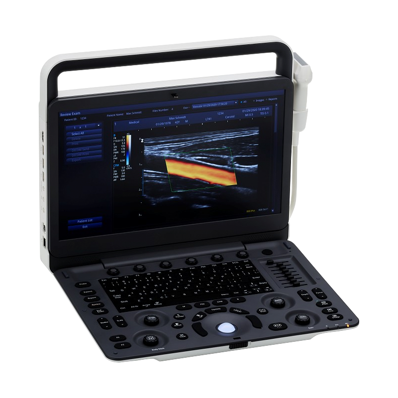 604-8190-XD1 Zimmer SonidoSmart Pro Ultralydsscanner