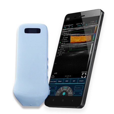 Trådløs Mini Ultralydsscanner C10CS